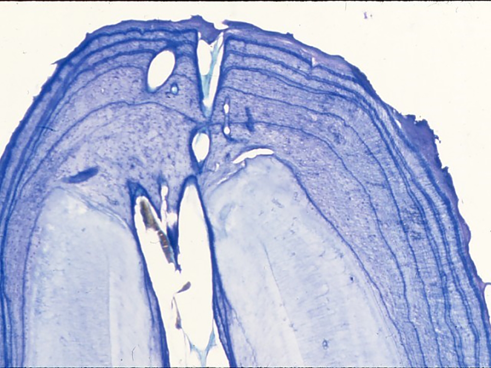 American black bear_U americanus_Minnesota_sectioned and stained tooth sample used to obtain age_Minnesota DNR